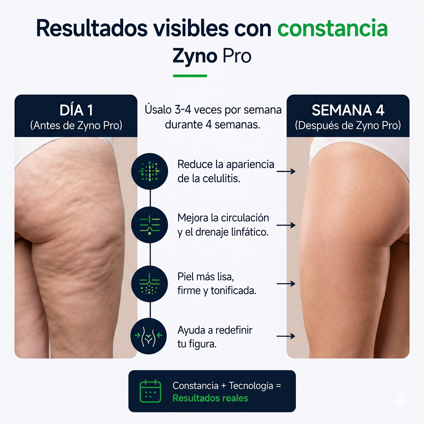Zyno Pro - Tu Aliado Anticelulitis