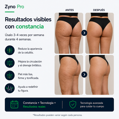 Zyno Pro - Tu Aliado Anticelulitis