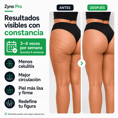 ZynoPro - La solución a la Celulitis